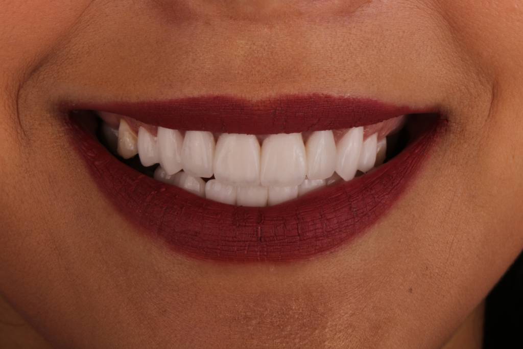 1.1after-1024x683